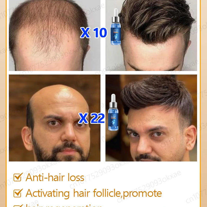 Fast Hair Growth Essence Oil Products Effective Baldness Repair